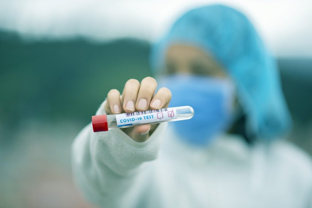 UEFA danas testira igrače Zvezde na korona virus
